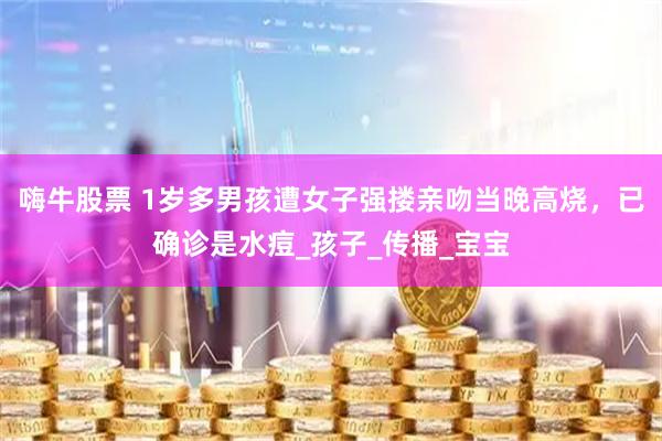 嗨牛股票 1岁多男孩遭女子强搂亲吻当晚高烧，已确诊是水痘_孩子_传播_宝宝
